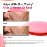 سرم نیاسینامید 10% + ترانگزامیک اسید 4% آنوا - تصویر 5